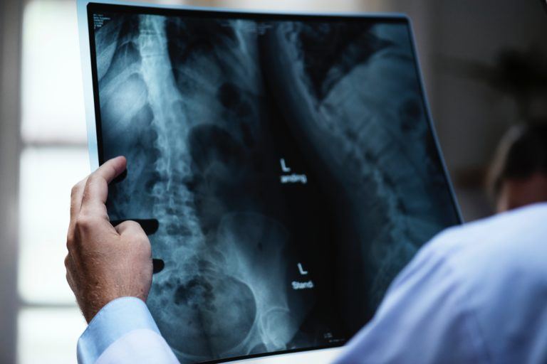 How Long Do Medical Negligence Claims Take To Settle Hart Brown
